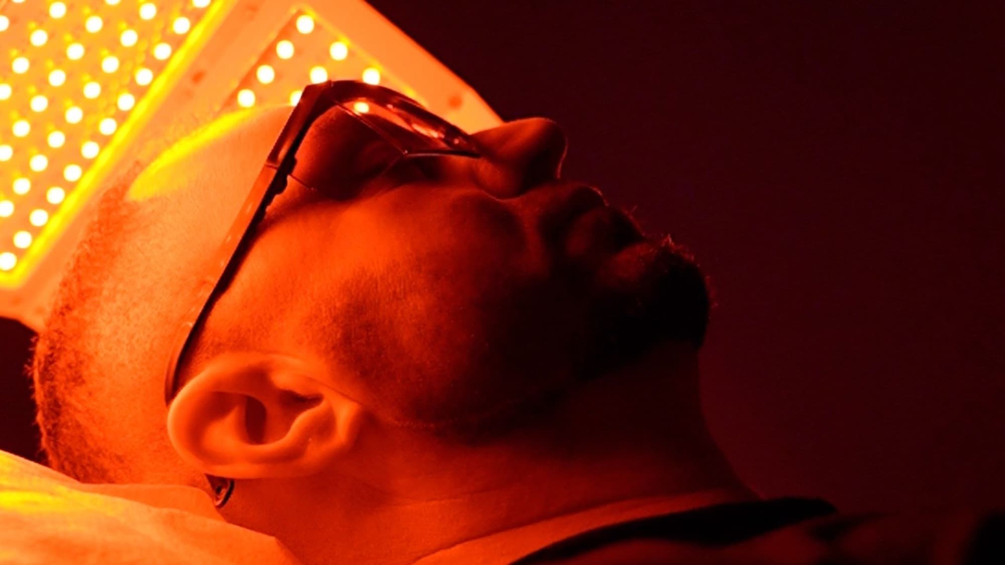 Hair Laser (LLLT)