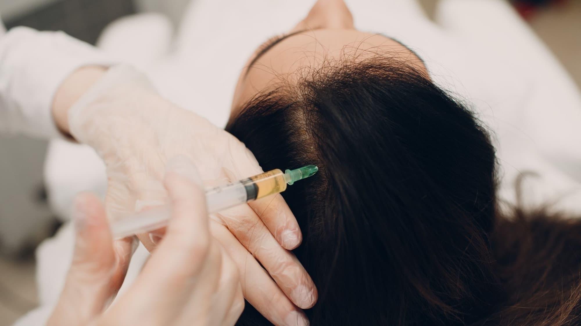 Hair Mesotherapy